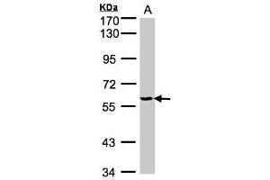 Western Blotting (WB) image for anti-Tyrosyl-tRNA Synthetase (Yars) (AA 357-520) antibody (ABIN467437) (YARS Antikörper  (AA 357-520))