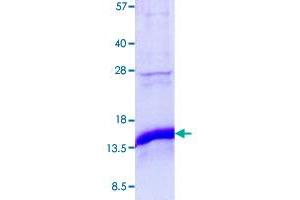 Image no. 1 for CDGSH Iron Sulfur Domain 1 (CISD1) (AA 32-108) protein (His tag) (ABIN5569968)