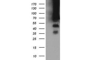 Image no. 8 for anti-tRNA Methyltransferase 2 Homolog A (TRMT2A) antibody (ABIN1501515) (TRMT2A Antikörper)