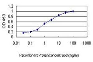 Detection limit for recombinant GST tagged SURB7 is approximately 0. (MED21 Antikörper  (AA 1-144))