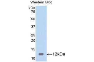 Western Blotting (WB) image for anti-S100 Calcium Binding Protein B (S100B) (AA 1-92) antibody (ABIN3201460)