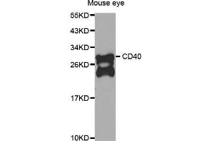 Western Blotting (WB) image for anti-CD40 (CD40) antibody (ABIN6213680) (CD40 Antikörper)