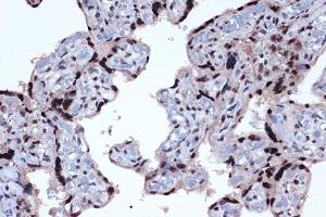 Immunohistochemistry (IHC) image for anti-Jun D Proto-Oncogene (JUND) antibody (ABIN7268051)