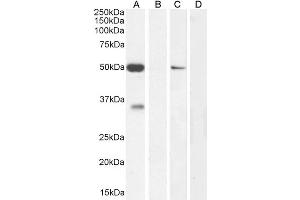 ABIN6391378 (0. (KCNN4 Antikörper  (Internal Region))