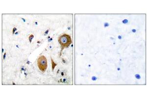 Immunohistochemical analysis of paraffin-embedded human brain tissue using GluR8 antibody (ABIN5976415). (GRM8 Antikörper  (C-Term))