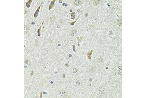 Immunohistochemistry of paraffin-embedded rat brain using SLC1A4 antibody. (SLC1A4 Antikörper  (AA 140-220))