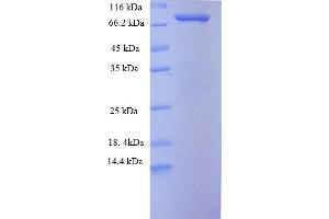 SDS-PAGE (SDS) image for Stress-Induced-phosphoprotein 1 (STIP1) (AA 1-543), (full length) protein (His-SUMO Tag) (ABIN5710426)