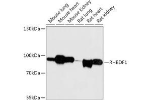 Western blot analysis of extracts of various cell lines, using RHBDF1 antibody (ABIN7269977) at 1:1000 dilution. (RHBDF1 Antikörper  (AA 200-400))