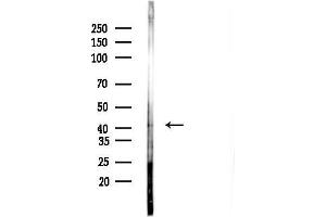 anti-Mitochondrial Carrier 1 (MTCH1) (N-Term) antibody