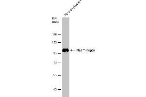 Western Blotting (WB) image for anti-Plasminogen (PLG) antibody (ABIN2855505)