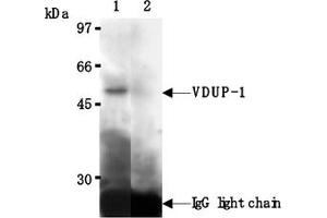 Western Blotting (WB) image for anti-Thioredoxin Interacting Protein (TXNIP) antibody (ABIN567793) (TXNIP Antikörper)