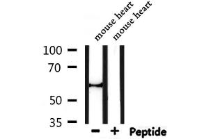 Western blot analysis of extracts from mouse heart, using Perilipin A Antibody.