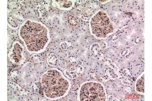 Immunohistochemistry (IHC) analysis of paraffin-embedded Human Kidney, antibody was diluted at 1:100. (BST2 Antikörper  (Internal Region))