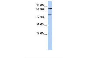 Image no. 1 for anti-Denticleless E3 Ubiquitin Protein Ligase Homolog (DTL) (AA 182-231) antibody (ABIN6738232) (CDT2/RAMP Antikörper  (AA 182-231))