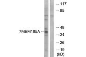 Western Blotting (WB) image for anti-Transmembrane Protein 185A (TMEM185A) (AA 290-339) antibody (ABIN2891088) (TMEM185A Antikörper  (AA 290-339))