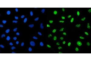 IF analysis of CRTC3 using anti-CRTC3 antibody (ABIN7599779). (CRTC3 Antikörper  (AA 116-619))