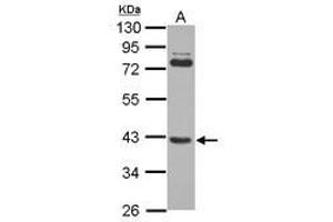 Image no. 2 for anti-SET and MYND Domain Containing 3 (SMYD3) (AA 21-416) antibody (ABIN1501007)