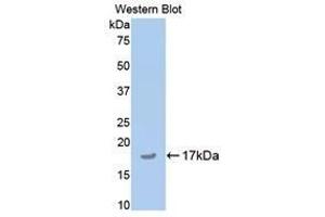 Western Blotting (WB) image for anti-Cartilage Oligomeric Matrix Protein (COMP) (AA 35-179) antibody (ABIN1174332)