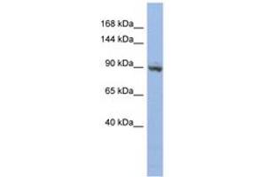 Image no. 1 for anti-Zinc Finger Protein 546 (ZNF546) (AA 143-192) antibody (ABIN6742667) (ZNF546 Antikörper  (AA 143-192))