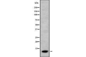 Western blot analysis of CCL26 using COLO205 whole cell lysates (CCL26 Antikörper  (Internal Region))