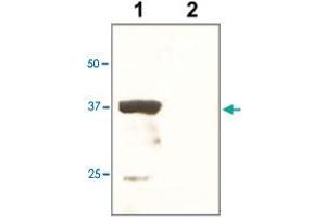 The tissue lysate derived from mouse kidney was immunoprobed by POU5F1 polyclonal antibody  at 1 : 500. (OCT4 Antikörper)