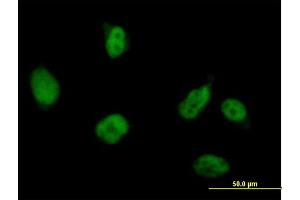 Immunofluorescence of purified MaxPab antibody to RUVBL2 on HeLa cell.