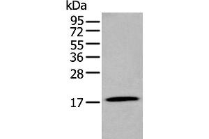 Western blot analysis of Human stomach tissue lysate using GKN2 Polyclonal Antibody at dilution of 1:250 (Gastrokine 2 Antikörper)