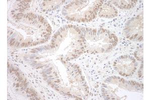 Immunohistochemistry (IHC) image for anti-RNA Binding Motif Protein 17 (RBM17) (AA 25-75) antibody (ABIN7448811) (RBM17 Antikörper  (AA 25-75))