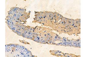 anti-PHD Finger Protein 20-Like 1 (PHF20L1) (N-Term) antibody