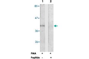Western blot analysis of extracts from Jurkat cells, treated with PMA (125 ng/ml, 30 mins), using FCGR2B polyclonal antibody . (FCGR2B Antikörper  (Ser363))