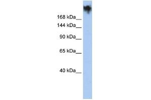 WB Suggested Anti-PKDREJ Antibody Titration:  0. (PKDREJ Antikörper  (Middle Region))