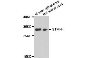 Western blot analysis of extracts of various cell lines, using STMN4 antibody (ABIN5975820) at 1/1000 dilution. (STMN4 Antikörper)