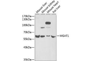 Western blot analysis of extracts of various cell lines, using MG antibody (ABIN6132348, ABIN6143808, ABIN6143810 and ABIN6222011) at 1:1000 dilution. (MGAT1 Antikörper  (AA 156-445))