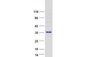 Western Blotting (WB) image for Carbonyl Reductase 1 (CBR1) protein (Myc-DYKDDDDK Tag) (ABIN2713140)