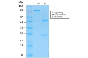 SDS-PAGE analysis of purified, BSA-free recombinant Cytokeratin 15 antibody (clone KRT15/2103R) as confirmation of integrity and purity. (KRT15 Antikörper)