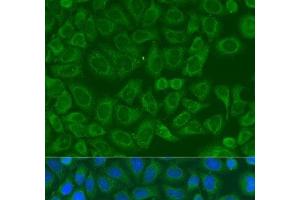 Immunofluorescence analysis of U2OS cells using ICK Polyclonal Antibody at dilution of 1:100. (ICK Antikörper)