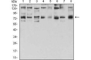 Western blot analysis using GFPT1 mouse mAb against Hela (1), HepG2 (2), HEK293 (3), BEL-7402 (4), SMMC-7721 (5), SK-MES-1 (6), C6 (7), and COS7 (8) cell lysate. (GFPT1 Antikörper  (AA 536-681))