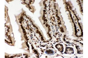Immunohistochemistry (IHC) image for anti-Lamin A/C (LMNA) (AA 481-646) antibody (ABIN3043295)