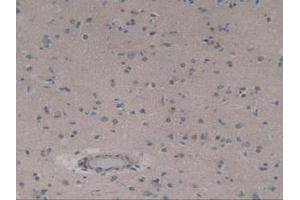 IHC-P analysis of Human Brain Tissue, with DAB staining. (ABCC8 Antikörper  (AA 679-929))