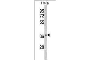 Western blot analysis of NFKBIA-S32/36 (ABIN652417 and ABIN2842077) in Hela cell line lysates (35 μg/lane).