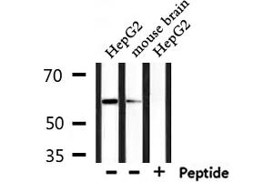 Western blot analysis of extracts from mouse brain and HepG2, using Caspase 10 Antibody. (Caspase 10 Antikörper)
