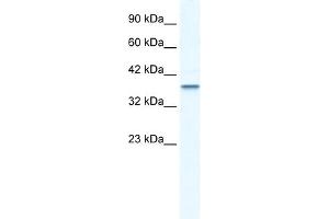 WB Suggested Anti-MTA1 Antibody Titration:  2. (MTA1 Antikörper  (C-Term))