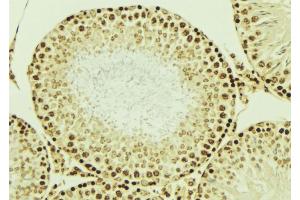 ABIN6276851 at 1/100 staining Mouse testis tissue by IHC-P. (LIG4 Antikörper  (C-Term))