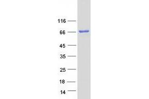 Western Blotting (WB) image for Acyl-CoA Oxidase 2, Branched Chain (Acox2) protein (Myc-DYKDDDDK Tag) (ABIN2714331)