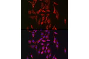 Immunofluorescence (IF) image for anti-Protein Kinase, AMP-Activated, beta 2 Non-Catalytic Subunit (PRKAB2) (AA 1-272) antibody (ABIN6146179)