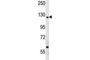 CUX1 antibody western blot analysis in MCF-7 lysate (CUX1 Antikörper  (AA 1347-1374))
