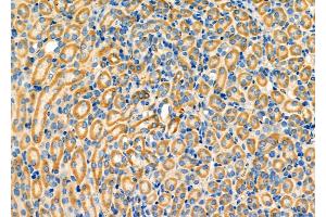 ABIN6263586 and ABIN6276332 at 1/100 staining Mouse kidney tissue by IHC-P.