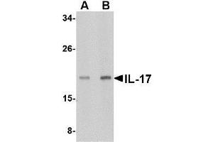 Western blot analysis of IL-17 in A-20 lysate with AP30409PU-N IL-17 antibody at (A) 2 and (B) 4 μg/ml. (Interleukin 17a Antikörper  (N-Term))