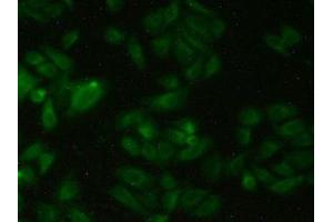Immunohistochemistry (IHC) image for anti-serpin Peptidase Inhibitor, Clade A (Alpha-1 Antiproteinase, Antitrypsin), Member 6 (SERPINA6) (AA 218-378) antibody (ABIN7437137)