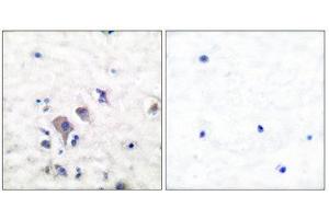 Immunohistochemistry (IHC) image for anti-Glutamate Receptor, Ionotropic, AMPA 2/3 (GRIA2/3) (C-Term) antibody (ABIN1848570) (mGluR2/3 Antikörper  (C-Term))